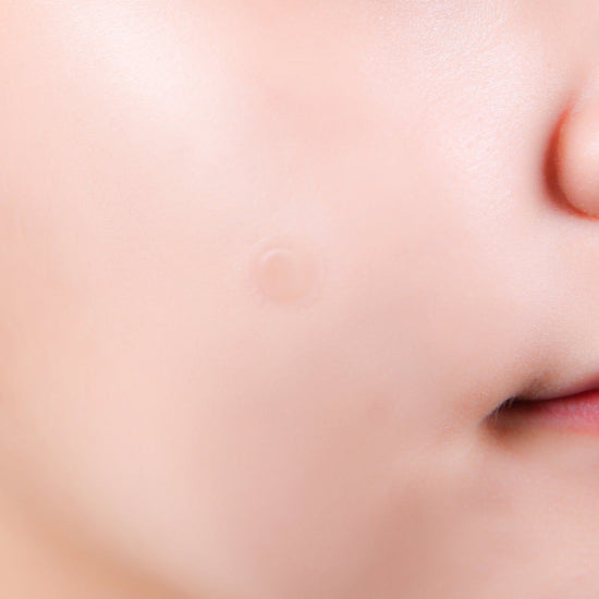 NEOGEN - A-Clear Soothing Spot Patch